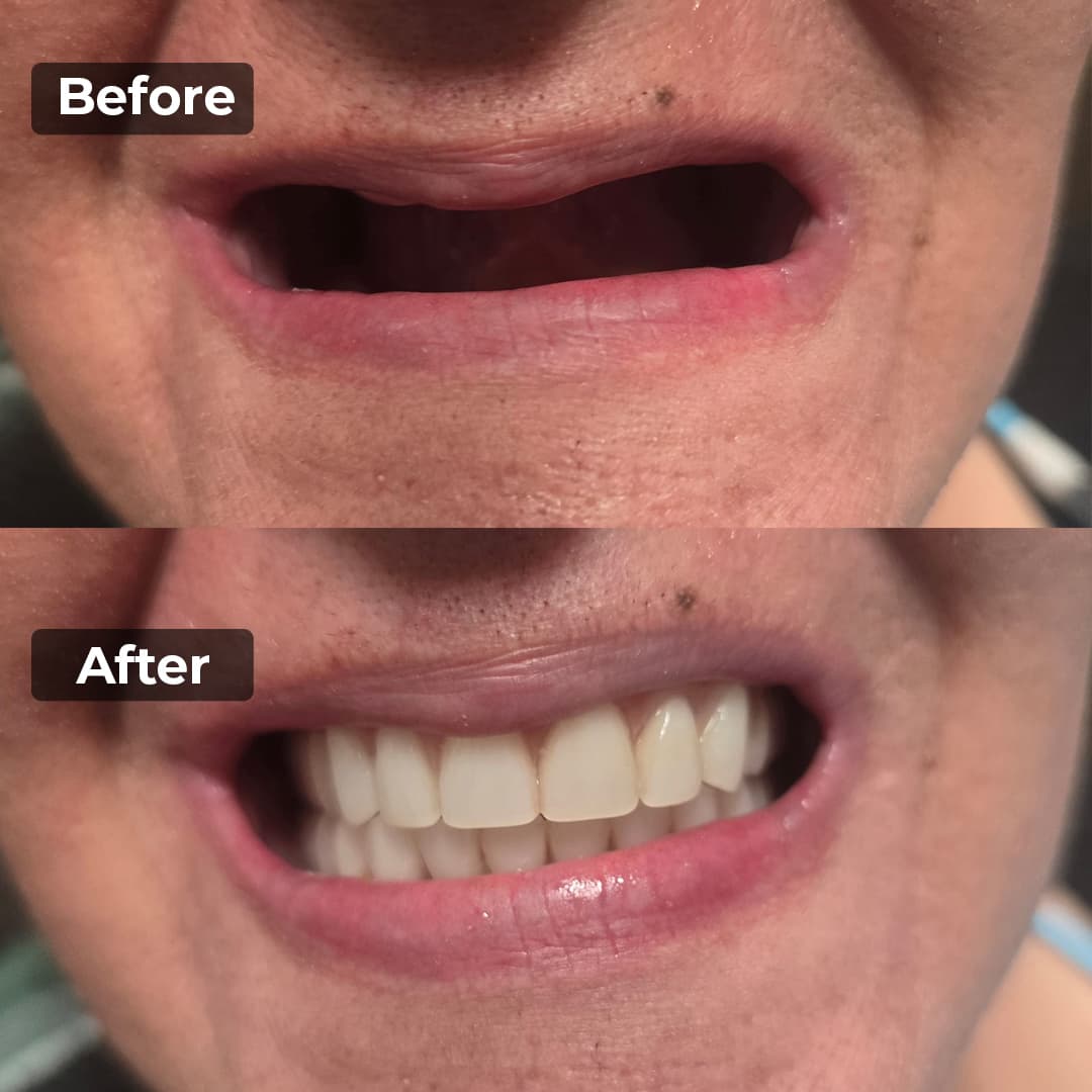 Smile transformation gallery photo 1 of 25