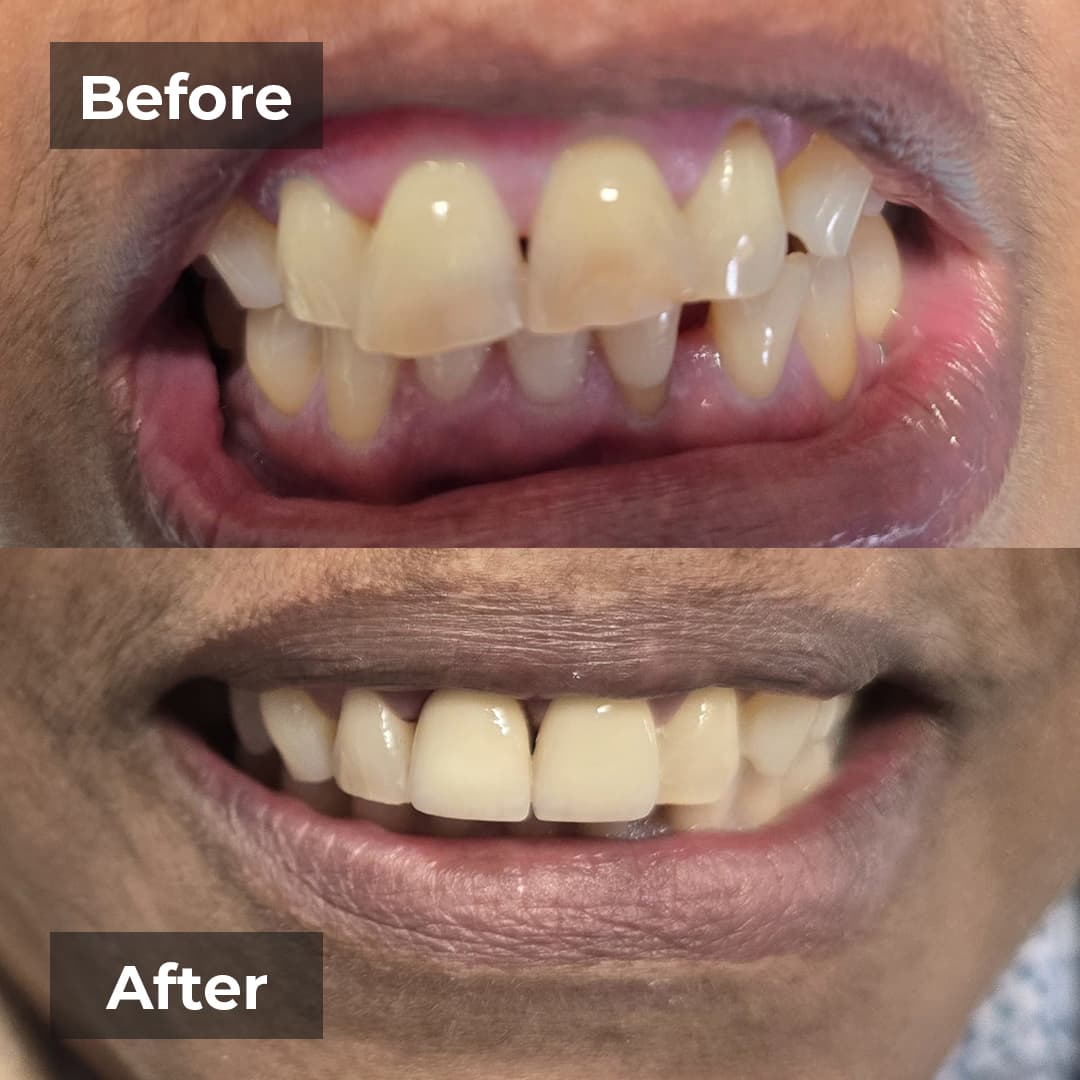 Smile transformation gallery photo 10 of 25
