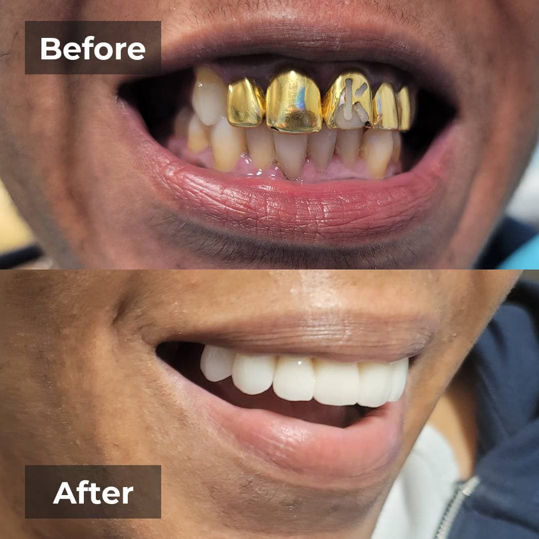 Smile transformation gallery photo 11 of 25