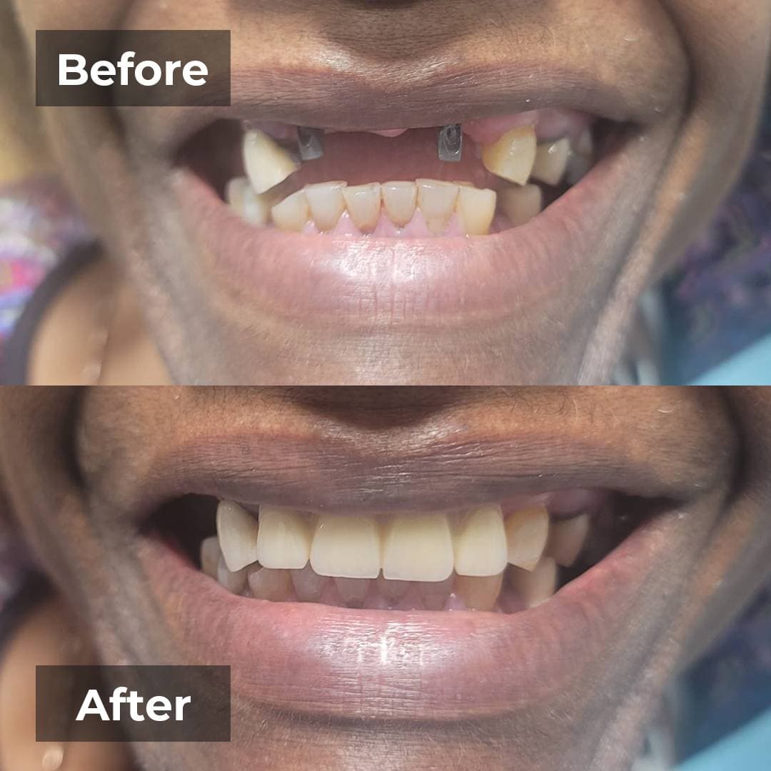 Smile transformation gallery photo 12 of 25