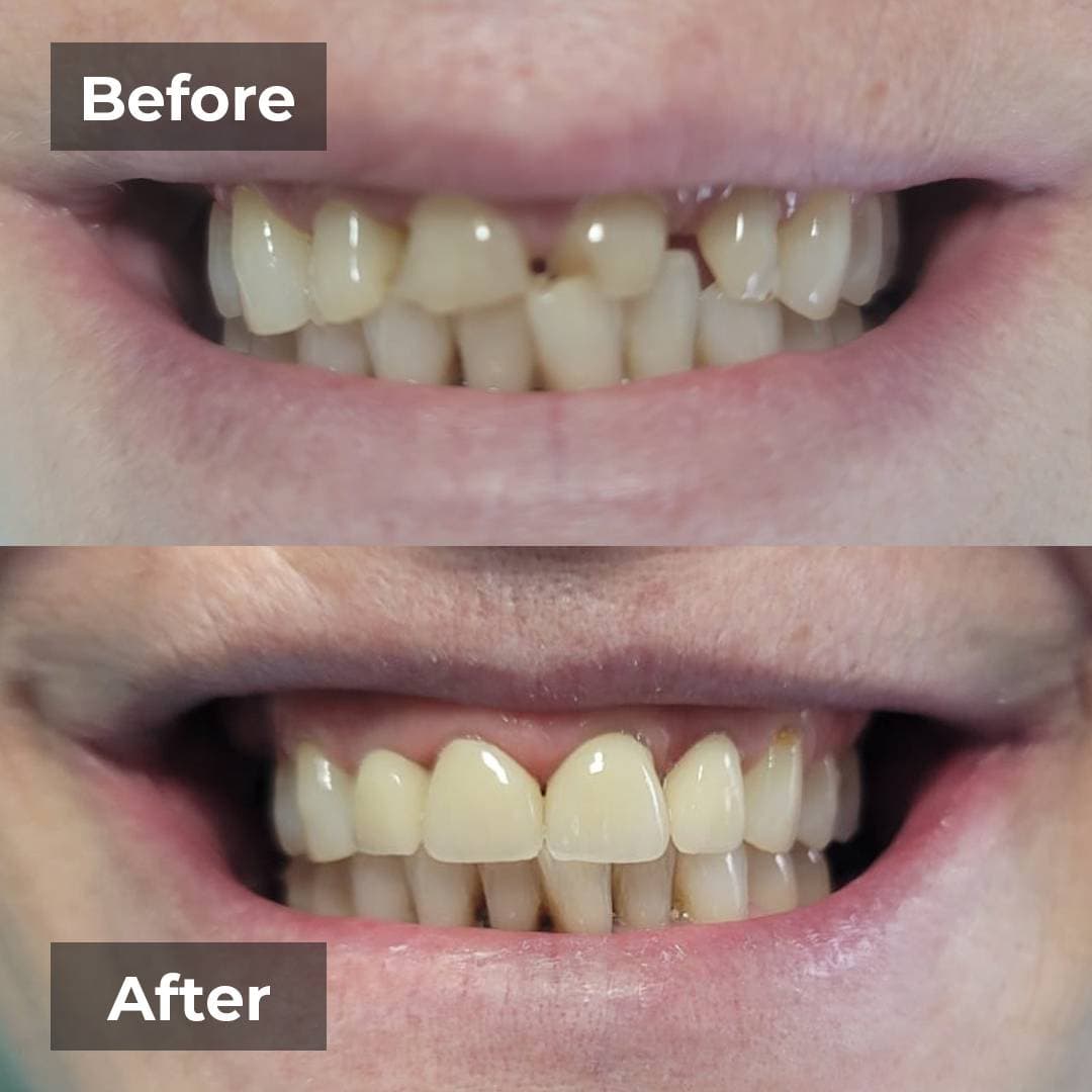 Smile transformation gallery photo 13 of 25