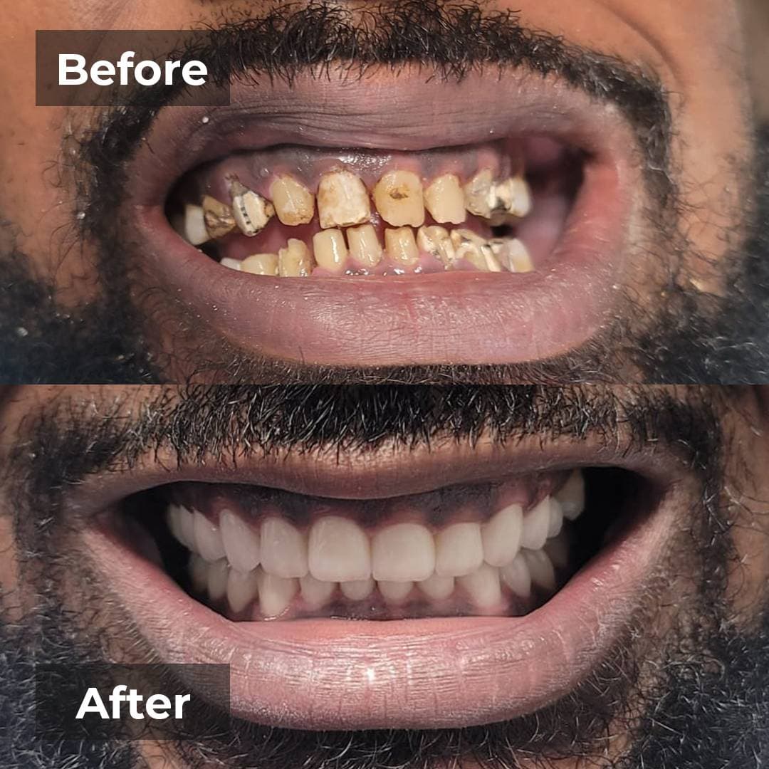 Smile transformation gallery photo 14 of 25