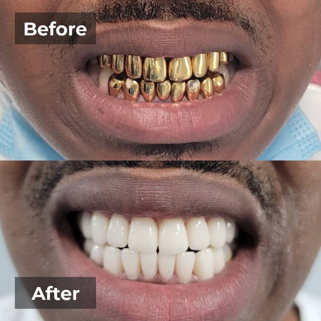 Smile transformation gallery photo 15 of 25