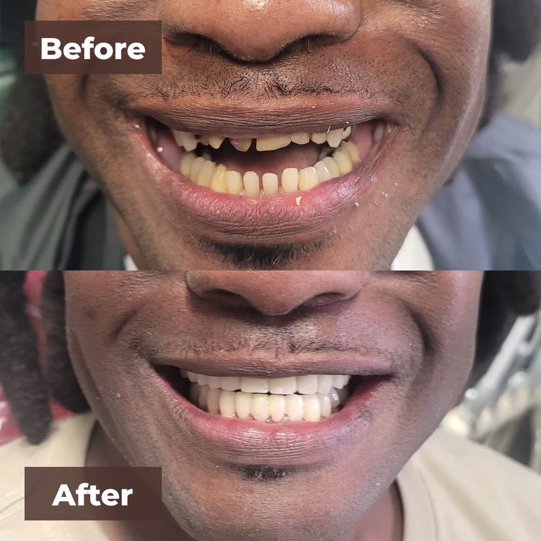 Smile transformation gallery photo 16 of 25