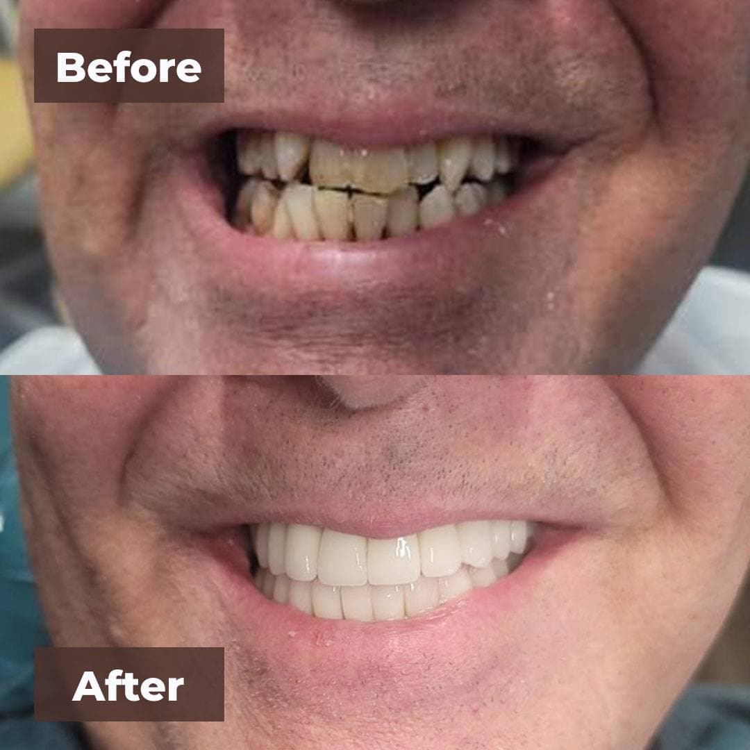Smile transformation gallery photo 17 of 25