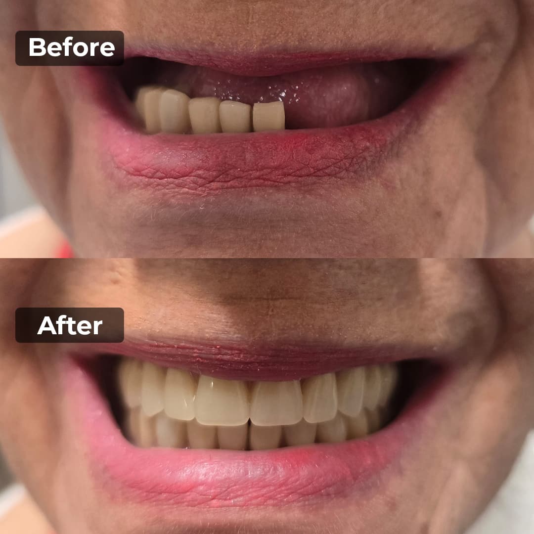 Smile transformation gallery photo 2 of 25