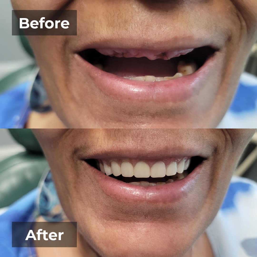 Smile transformation gallery photo 21 of 25