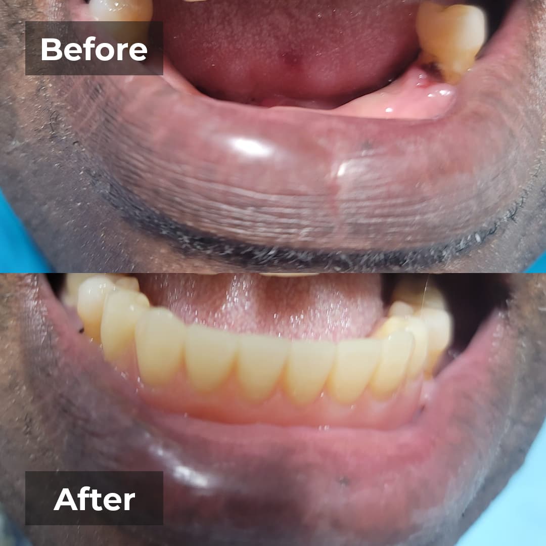 Smile transformation gallery photo 22 of 25