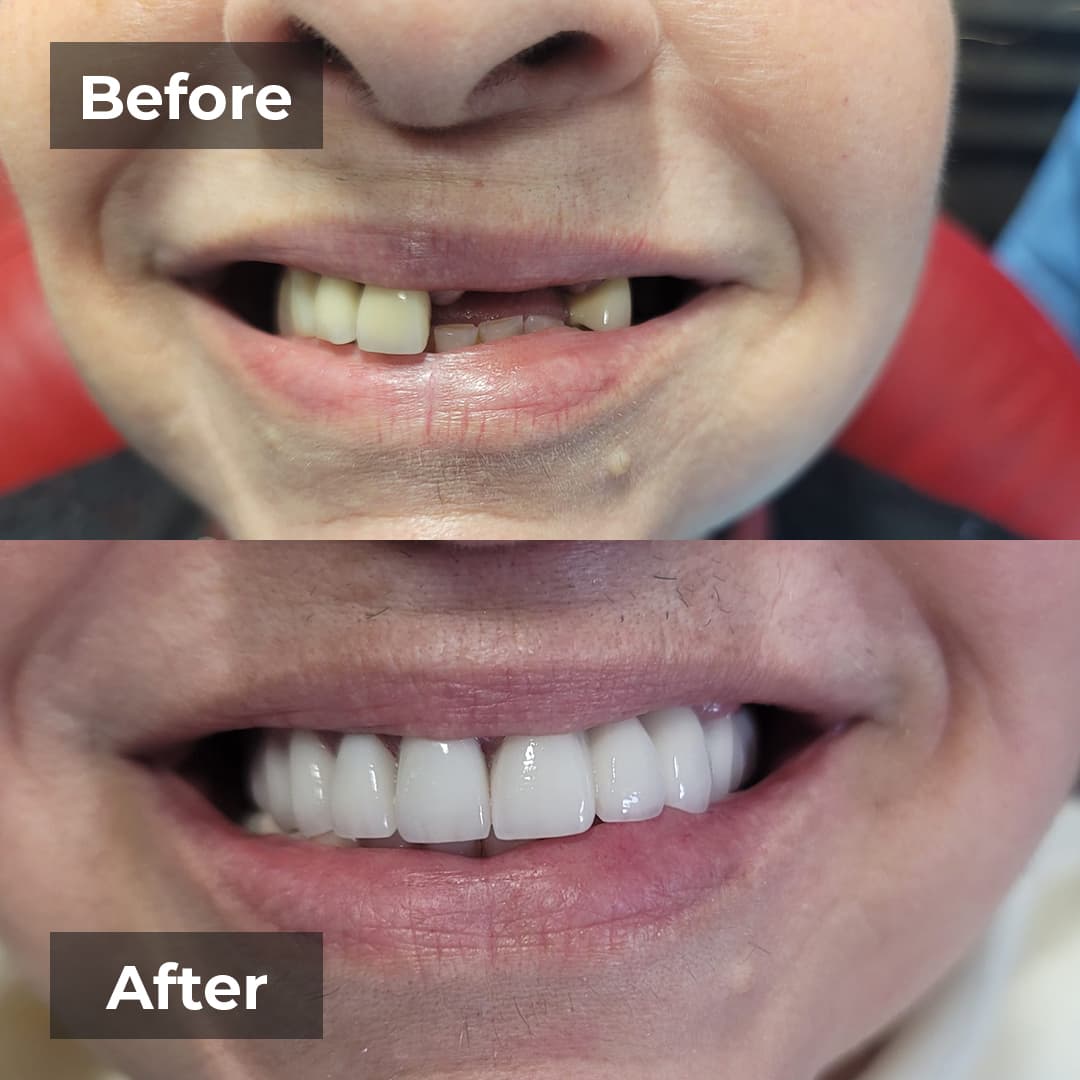 Smile transformation gallery photo 23 of 25