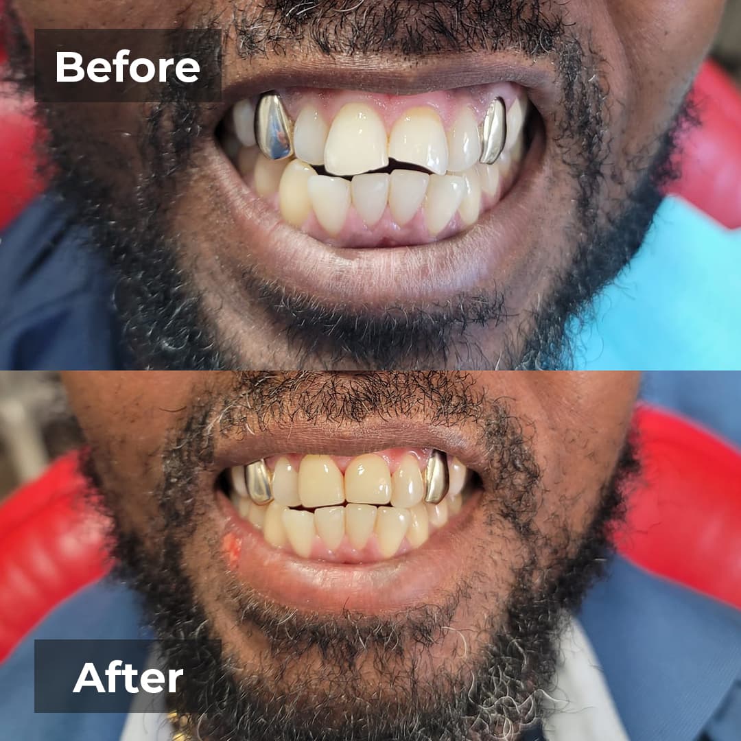 Smile transformation gallery photo 24 of 25
