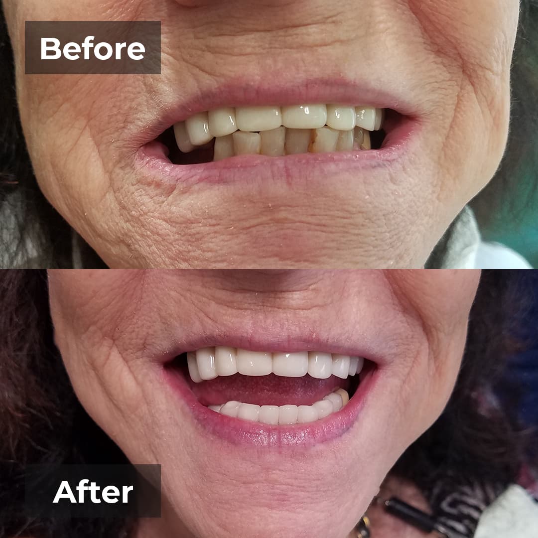 Smile transformation gallery photo 25 of 25