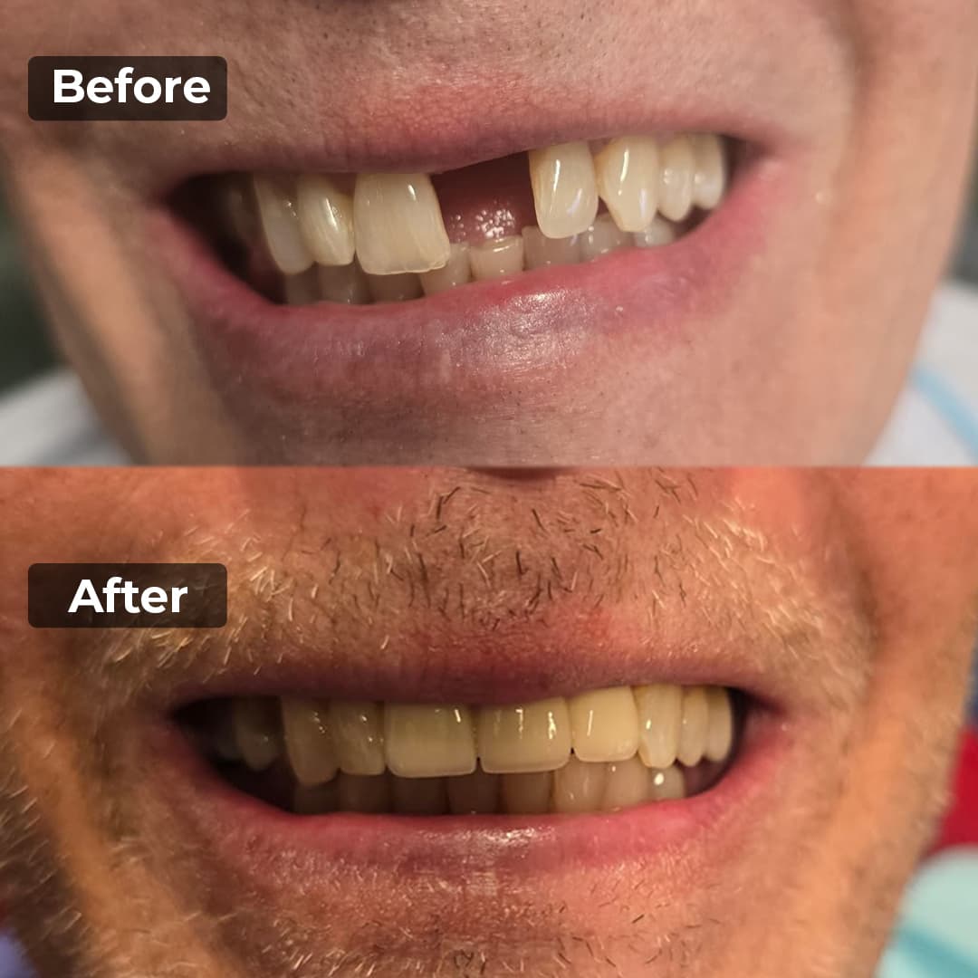 Smile transformation gallery photo 3 of 25
