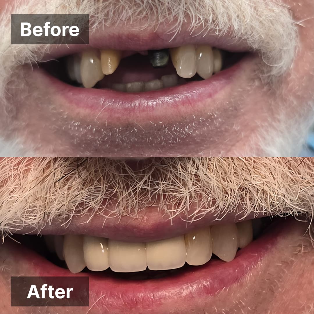 Smile transformation gallery photo 4 of 25