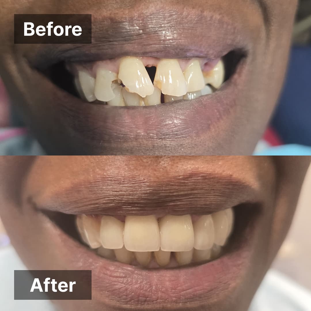 Smile transformation gallery photo 5 of 25