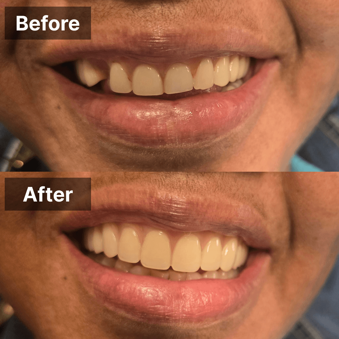 Smile transformation gallery photo 6 of 25