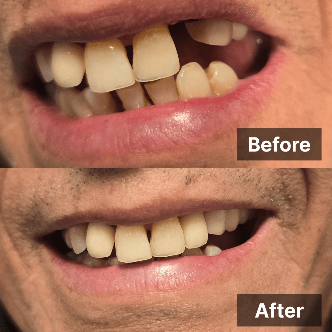 Smile transformation gallery photo 7 of 25