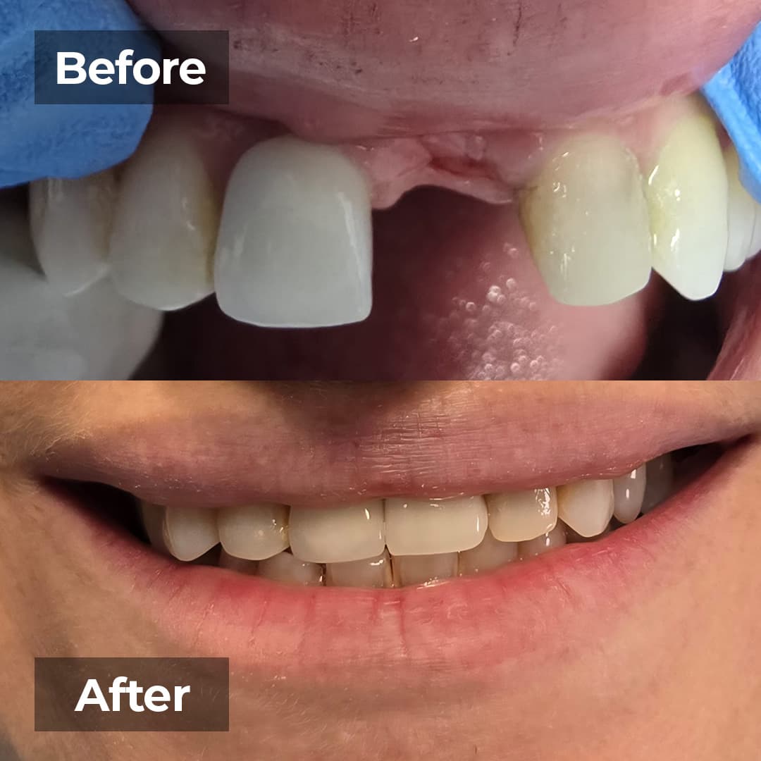 Smile transformation gallery photo 8 of 25
