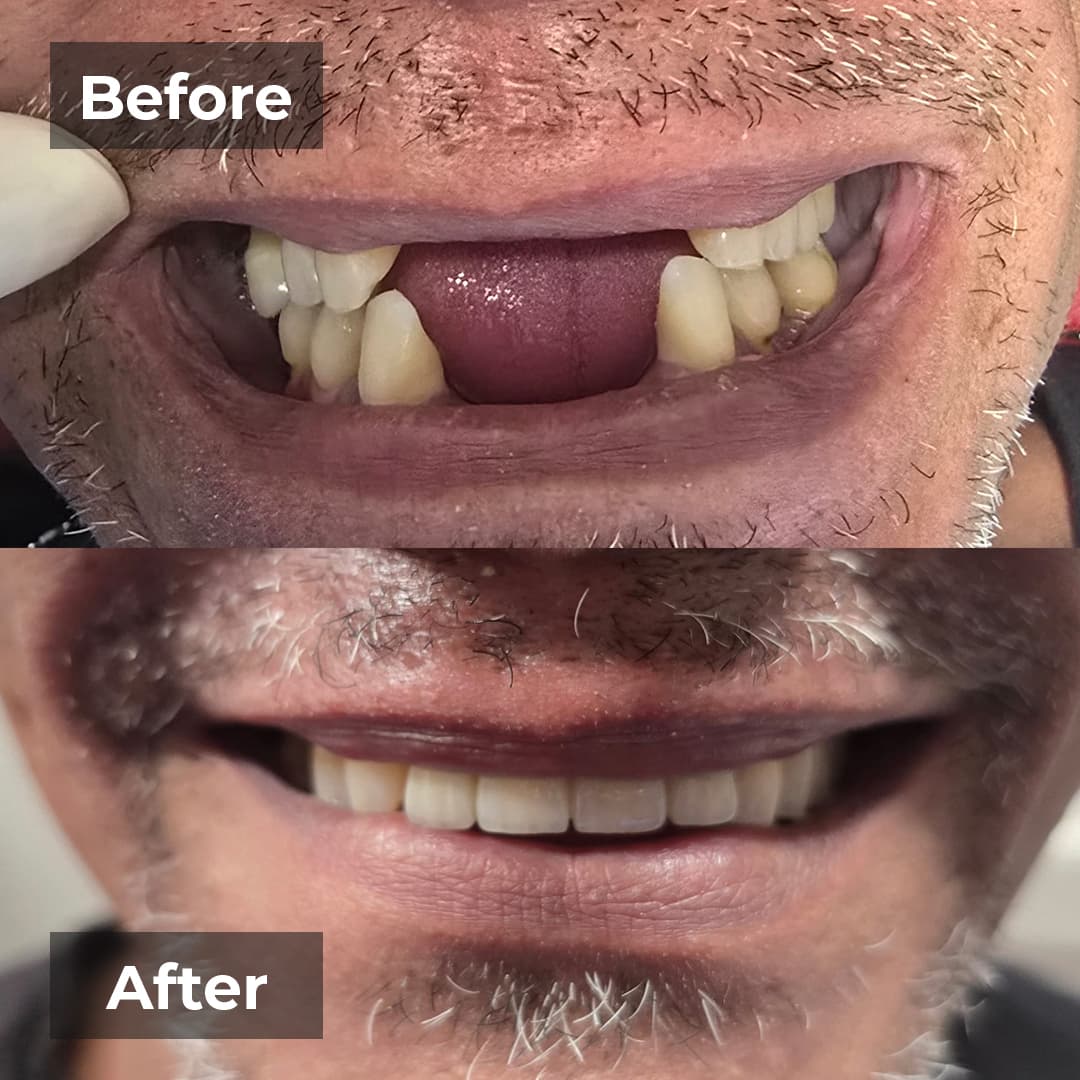 Smile transformation gallery photo 9 of 25
