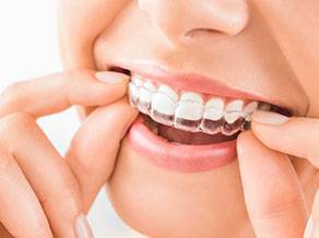 Invisalign Coral Springs