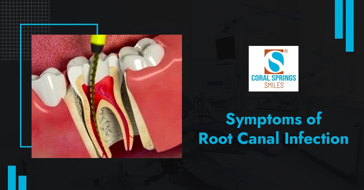 <strong>Root Canal Infection: Signs Your Tooth Needs Attention Again</strong>