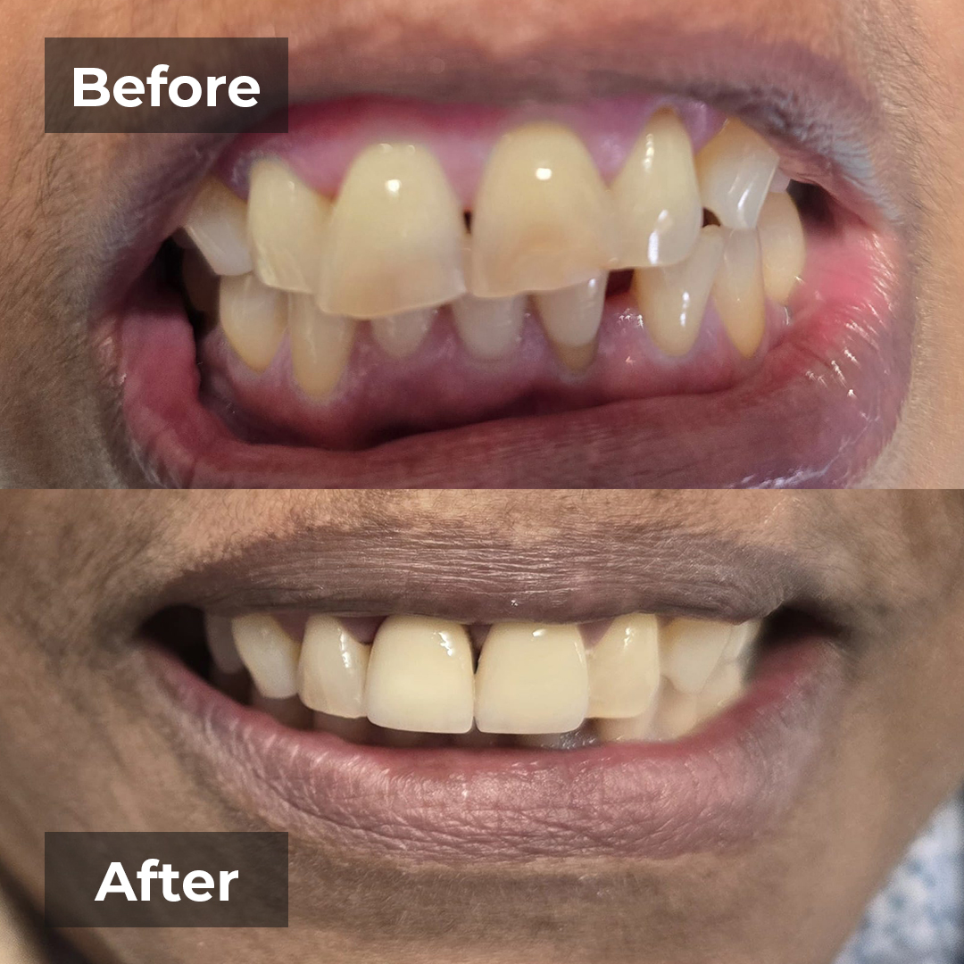 Testimonial-smile-gallery