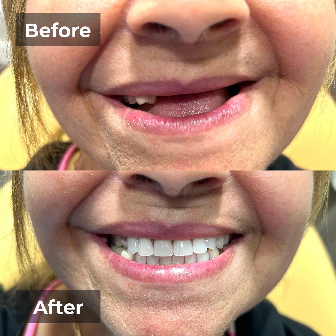 Testimonial-smile-gallery