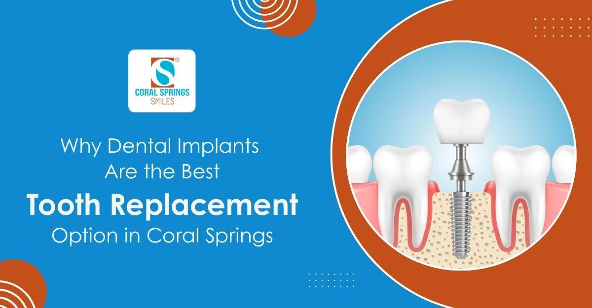 Dental Implants in Coral Springs,FL