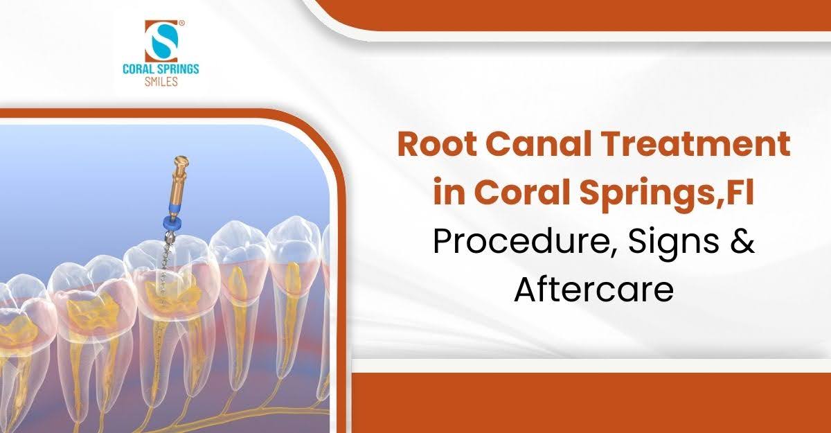 Root Canal Treatment in Coral Springs, FL